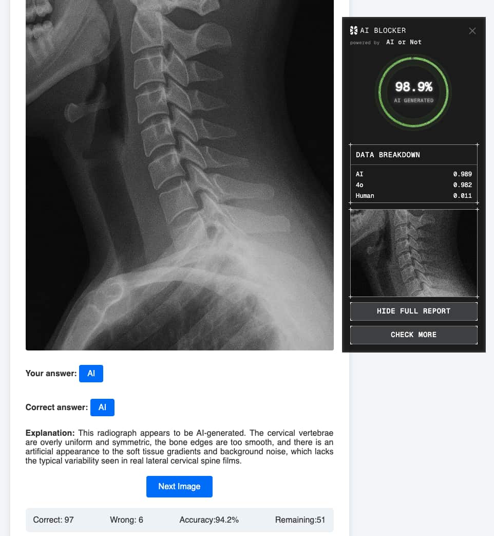 Cervical-spine radiograph generated by GPT-4o; AI or Not's verdict shown alongside (98.9% AI)