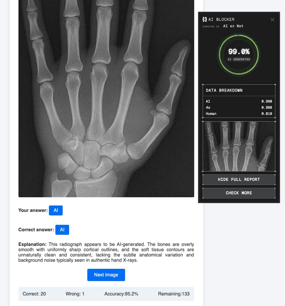 Hand radiograph generated by GPT-4o; AI or Not's verdict shown alongside (99.6% AI)