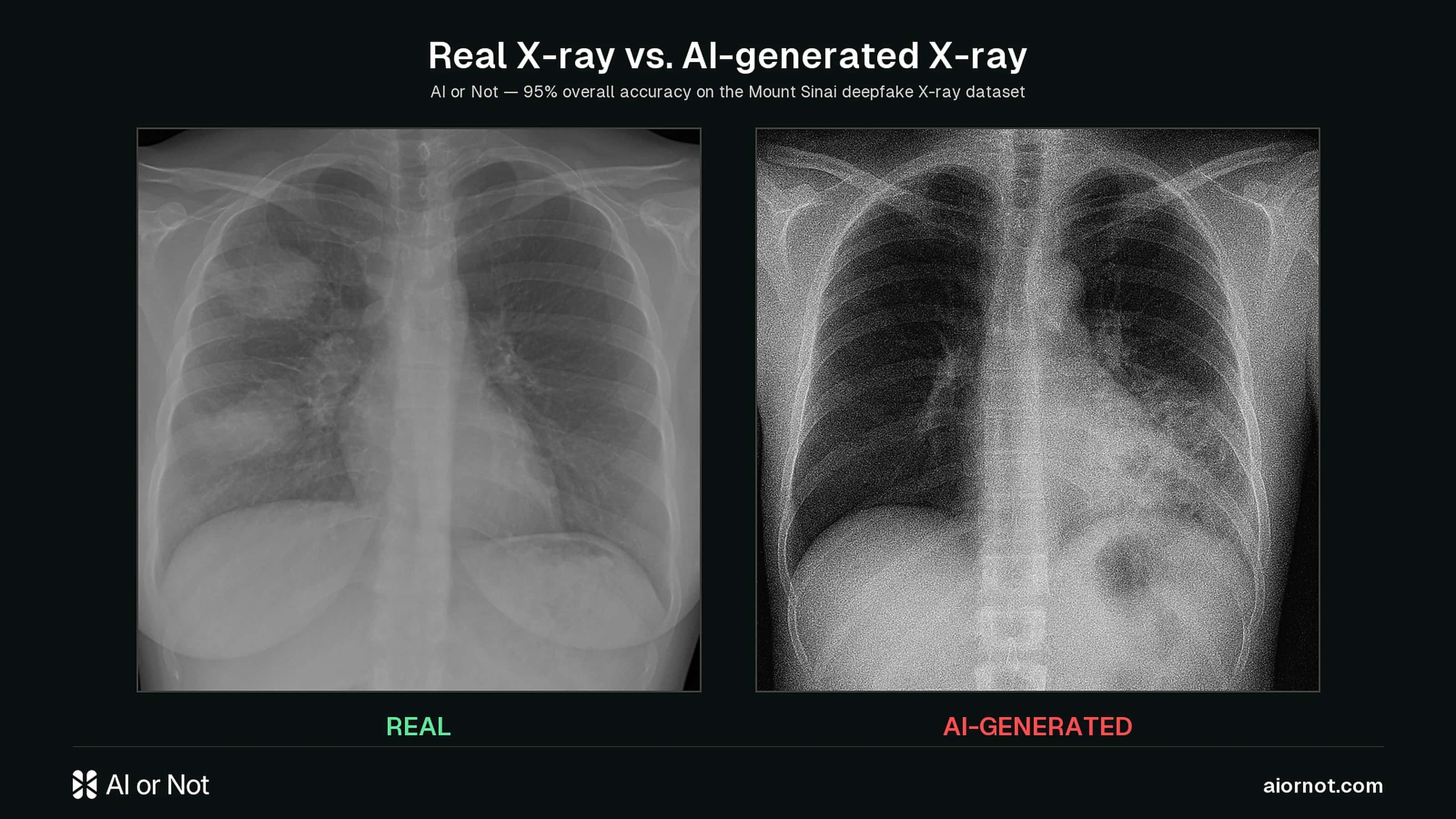 Side-by-side comparison: an authentic chest X-ray next to a GPT-4o-generated chest X-ray, on the AI or Not brand background Side-by-side comparison: an authentic chest X-ray next to a GPT-4o-generated chest X-ray, on the AI or Not brand background