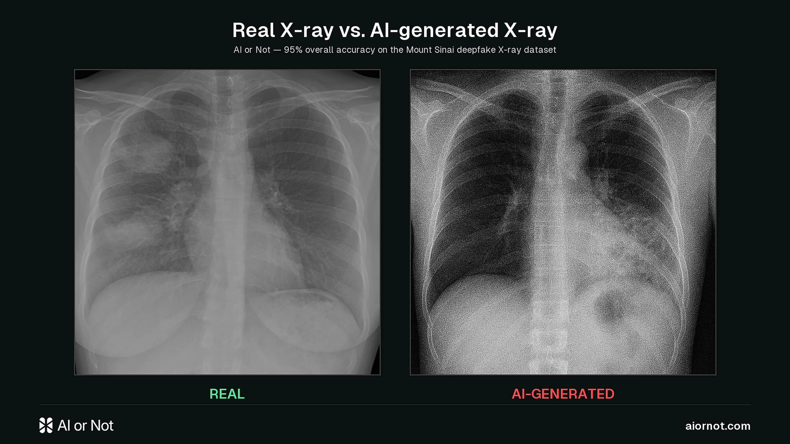 AI or Not Catches 100% of Deepfake X-Rays. Radiologists Caught 75%. AI or Not Catches 100% of Deepfake X-Rays. Radiologists Caught 75%.